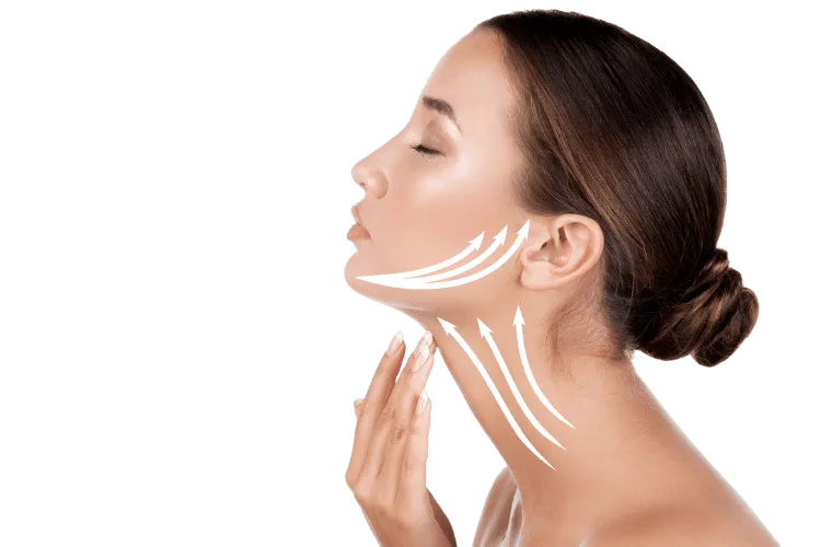 Temporal Lift- Şakak Germe